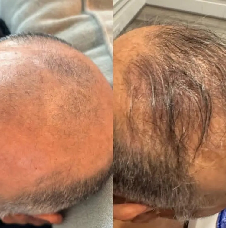 Botalab Deserticola Plus Shampoo, Conditioner & Oil Serum (3pc) - improve hair growth Botalab