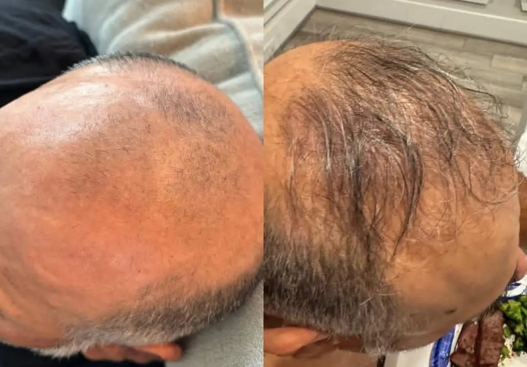 Botalab Deserticola Plus Shampoo, Conditioner & Oil Serum (3pc) - improve hair growth Botalab