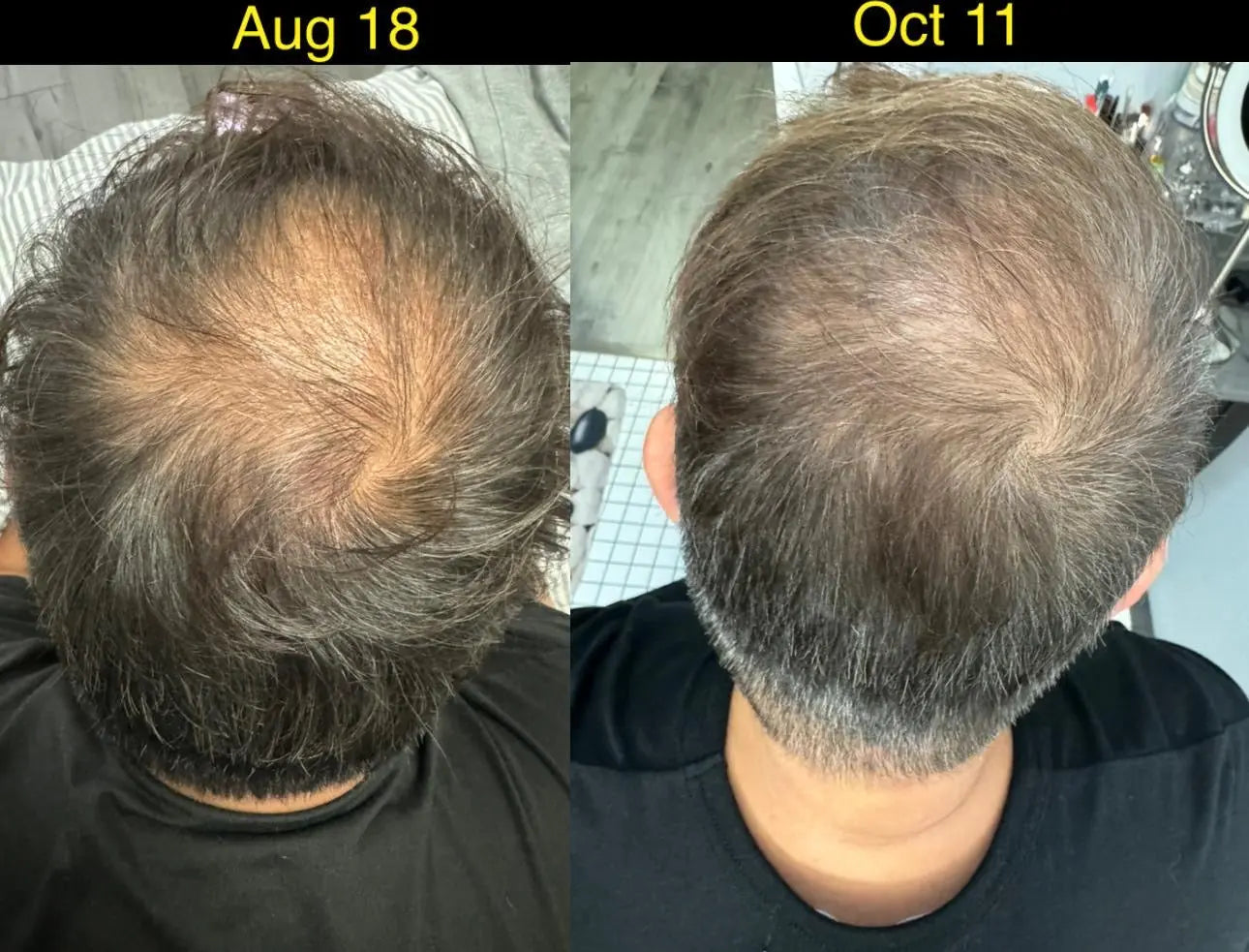 Botalab Deserticola Plus Shampoo, Conditioner & Oil Serum (3pc) - improve hair growth Botalab