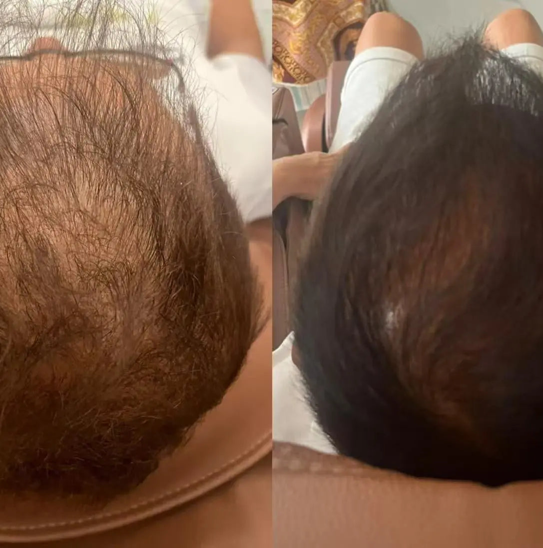 Botalab Deserticola Plus Shampoo, Conditioner & Oil Serum (3pc) - improve hair growth Botalab